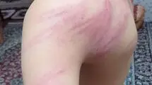 جزئیات اخراج معلمی که دانش آموزان را به شدت کتک زده بود
