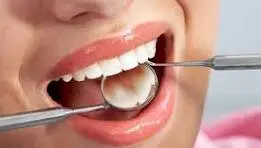 تاثیر مخرب رفلاکس معده بر سلامت دندان ها