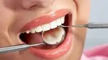 تاثیر مخرب رفلاکس معده بر سلامت دندان ها