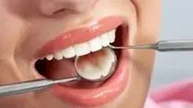 تاثیر مخرب رفلاکس معده بر سلامت دندان ها