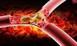 درمان طبیعی و سه سوته چربی و کلسترول خون