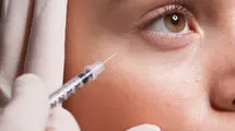 فریب فیلرهای ارزان و اینترنتی را نخورید