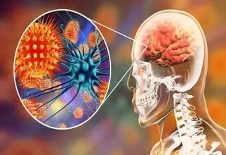 این ویروس باعث کند ذهنی می‌شود