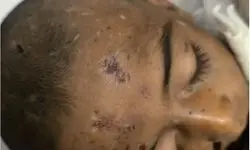 یک فقره کودک آزاری منجر به فوت در هرمزگان +تصاویر دلخراش