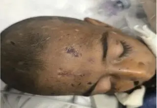 یک فقره کودک آزاری منجر به فوت در هرمزگان +تصاویر دلخراش