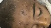 یک فقره کودک آزاری منجر به فوت در هرمزگان +تصاویر دلخراش