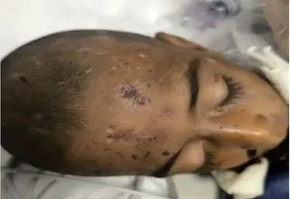 یک فقره کودک آزاری منجر به فوت در هرمزگان +تصاویر دلخراش