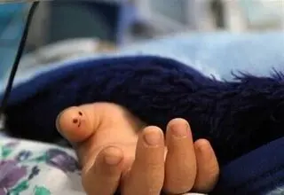 مرگ دلخراش کودک ۳ ساله همدانی بر اثر روباه‌گزیدگی