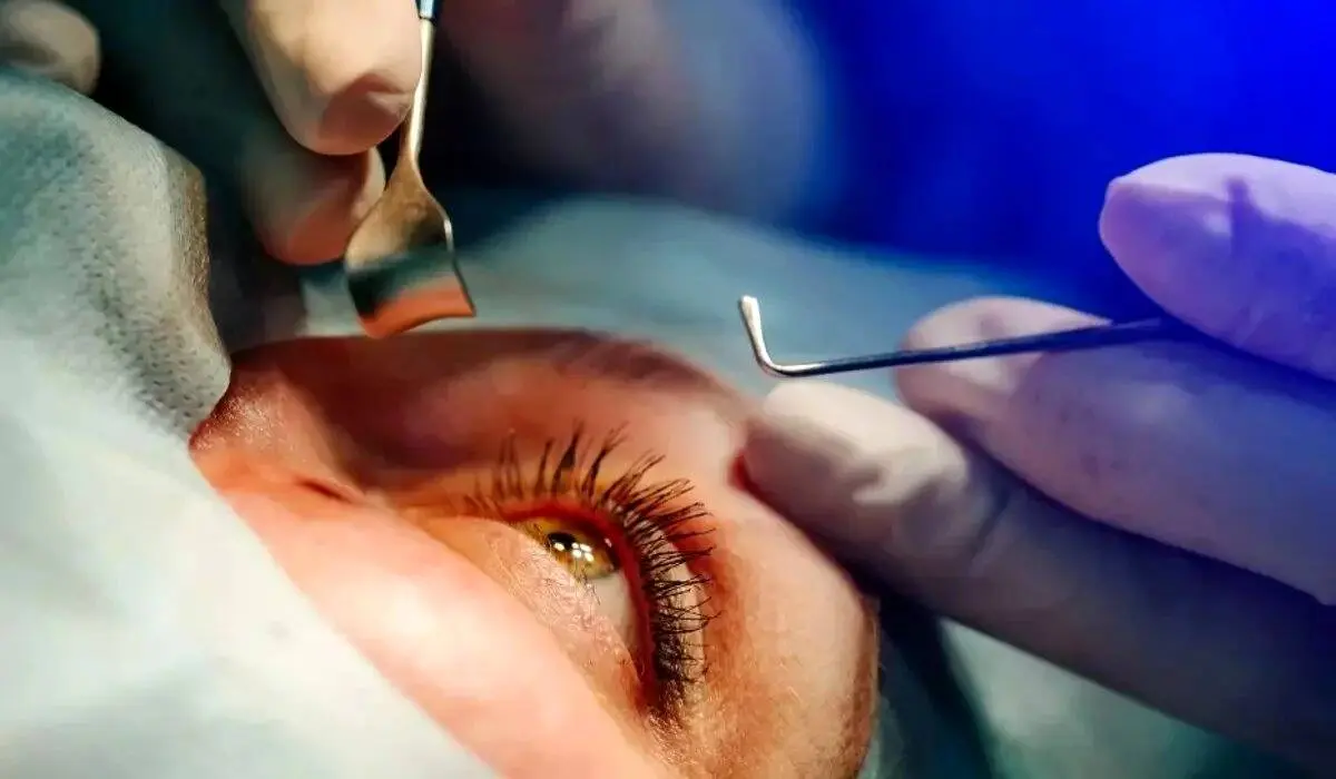 شیوع قوز قرنیه در ایران بالاتر از جهان 