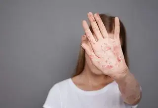 سرخک، زخم کهنه‌‌ای که سر باز  کرده است