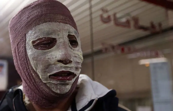 دیگِ رب، زن جوان را جزغاله کرد!