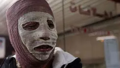 دیگِ رب، زن جوان را جزغاله کرد!