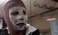 دیگِ رب، زن جوان را جزغاله کرد!