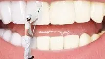 سفید کردن دندان زرد با روش‌های طبیعی و خانگی