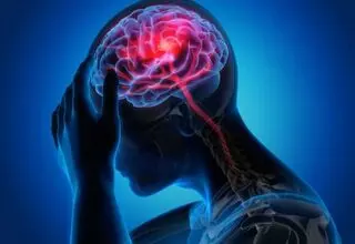 تشخیص فوری سکته مغزی از روی کف پا!