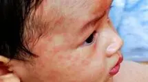 قاتلی که جان 95 هزار نفر را گرفت