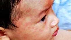 قاتلی که جان 95 هزار نفر را گرفت