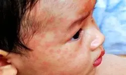 قاتلی که جان 95 هزار نفر را گرفت