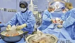 نجات جان پسر تهرانی با قلب نوجوان رشتی