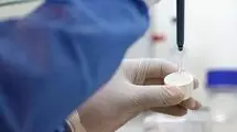  روسیه خطر همه‌گیری طاعون ریوی در سیبری را رد کرد