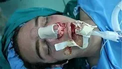 جزئیات باورنکردنی جراحی بینی بدون بیهوشی توسط دستیار دیپلمه پزشک 