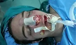 جزئیات باورنکردنی جراحی بینی بدون بیهوشی توسط دستیار دیپلمه پزشک 