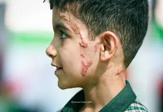 تصاویر تلخ و دردناک از محمد شرفی در پی حمله آمریکا به میناب + ببینید 