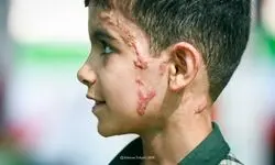 تصاویر تلخ و دردناک از محمد شرفی در پی حمله آمریکا به میناب + ببینید 