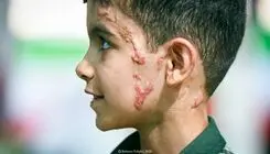 تصاویر تلخ و دردناک از محمد شرفی در پی حمله آمریکا به میناب + ببینید 