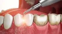 ارائه خدمات دهان و دندان به کودکان زیر ۱۴ سال و مادران باردار و شیرده تحت پوشش کمیته امداد