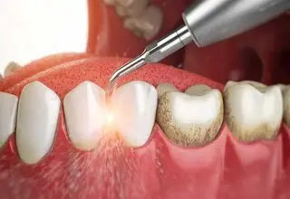 سلامت تضمینی دندان‌ها با این راهکار
