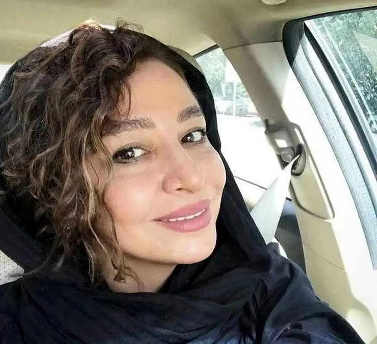 صورت جدید مهلقا باقری: تغییرات پس از عمل زیبایی جنجال به پا کرد!