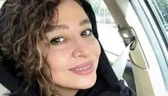 صورت جدید مه‌لقا باقری: تغییرات  پس از عمل زیبایی جنجال به پا کرد!