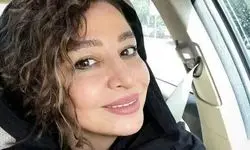 صورت جدید مه‌لقا باقری: تغییرات  پس از عمل زیبایی جنجال به پا کرد!
