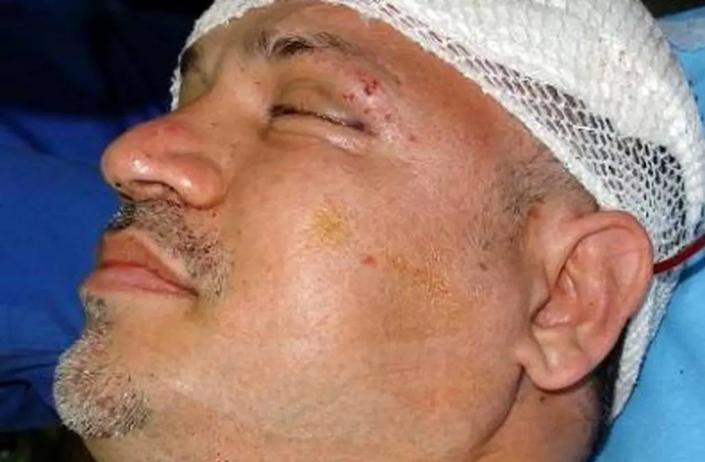 نجات معجزه آسای علی دایی از مرگ / وقتی ماشینم را دیدم گفتم خدایا من چطور زنده ماندم؟ خدا رحم کرد ...+ فیلم