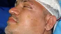 نجات معجزه آسای علی دایی از مرگ / وقتی ماشینم را دیدم گفتم خدایا من چطور زنده ماندم؟ خدا رحم کرد ...+ فیلم