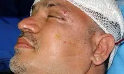 نجات معجزه آسای علی دایی از مرگ / وقتی ماشینم را دیدم گفتم خدایا من چطور زنده ماندم؟ خدا رحم کرد ...+ فیلم