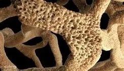 زندگی روی استخوان‌های شکننده 