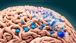 میکروپلاستیک‌ها به مغز استخوان انسان نیز نفوذ کرده اند