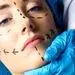 جراحت فرم و شکل به قیمت سلامت/ جراحی زیبایی رویایی گاه به بهای جان