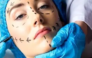 جراحت فرم و شکل به قیمت سلامت/ جراحی زیبایی رویایی گاه به بهای جان
