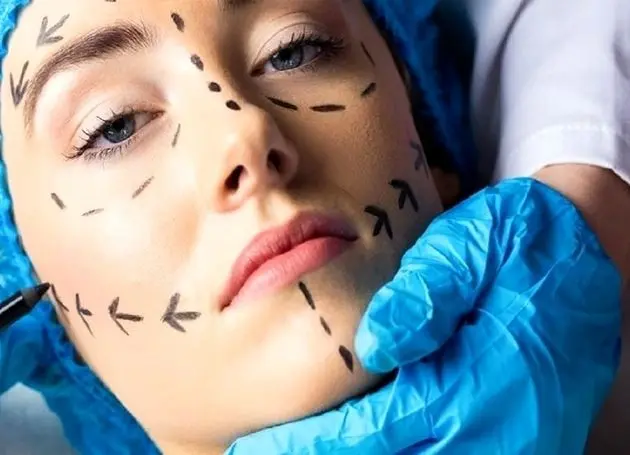 جراحت فرم و شکل به قیمت سلامت/ جراحی زیبایی رویایی گاه به بهای جان