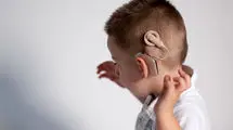 عمل کاشت حلزون تا سن ۴ سالگی رایگان است