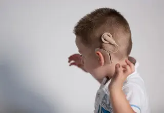 عمل کاشت حلزون تا سن ۴ سالگی رایگان است