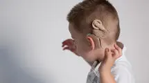 عمل کاشت حلزون تا سن ۴ سالگی رایگان است