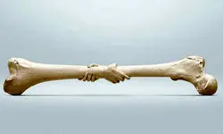  ۴۲ درصد زنان بالای ۶۰ سال و ۲۴ درصد آقایان بالای ۵۰ سال به این بیماری مبتلا هستند