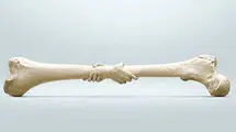  ۴۲ درصد زنان بالای ۶۰ سال و ۲۴ درصد آقایان بالای ۵۰ سال به این بیماری مبتلا هستند