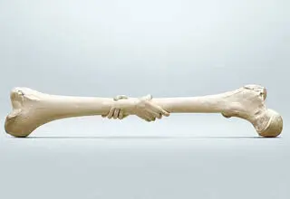  ۴۲ درصد زنان بالای ۶۰ سال و ۲۴ درصد آقایان بالای ۵۰ سال به این بیماری مبتلا هستند