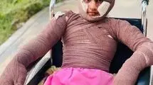 «هدا»، دختری از میناب/ مستندی درباره یکی از بازماندگان جنگ رمضان