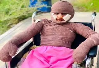 «هدا»، دختری از میناب/ مستندی درباره یکی از بازماندگان جنگ رمضان